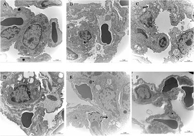 Research on the metabolic regulation mechanism of Yangyin Qingfei decoction plus in severe pneumonia caused by Mycoplasma pneumoniae in mice